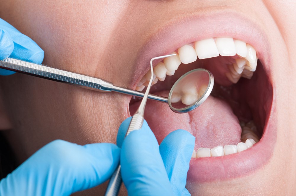 Deep clean Melbourne family dentist Glenroy