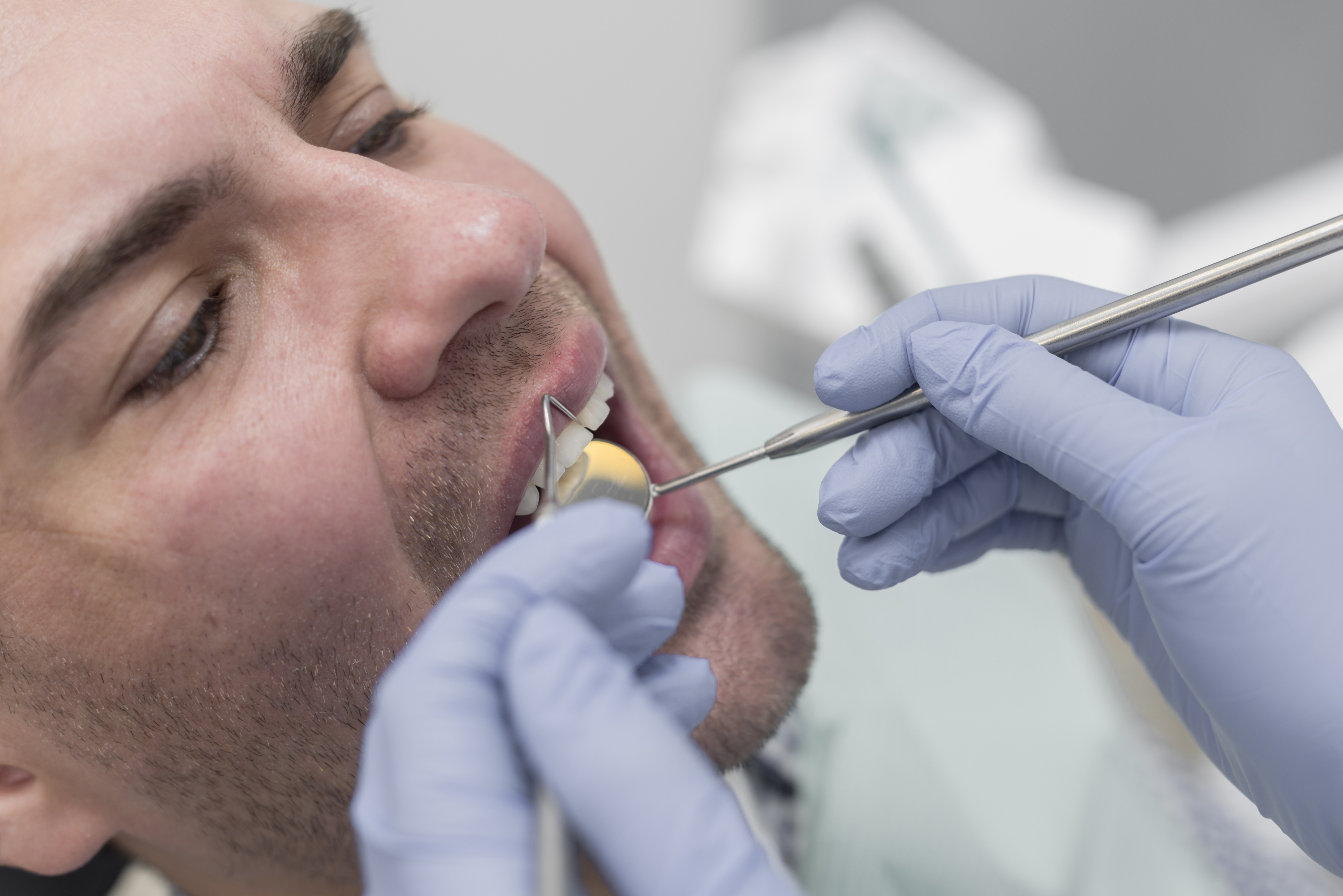 Tooth Fillings Melbourne – Cavity Repair