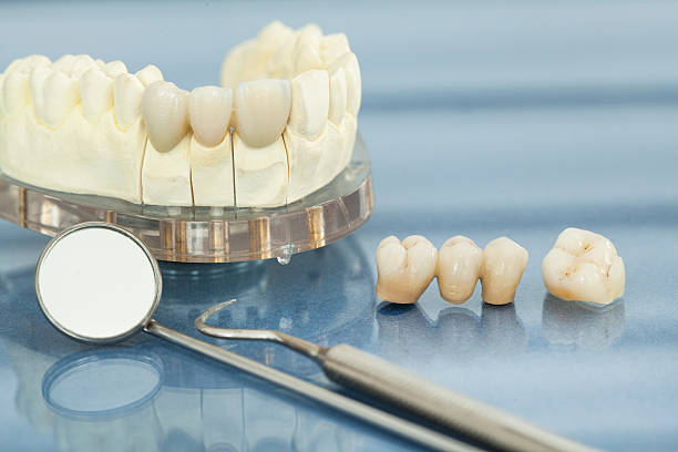Dental Crown & Bridges