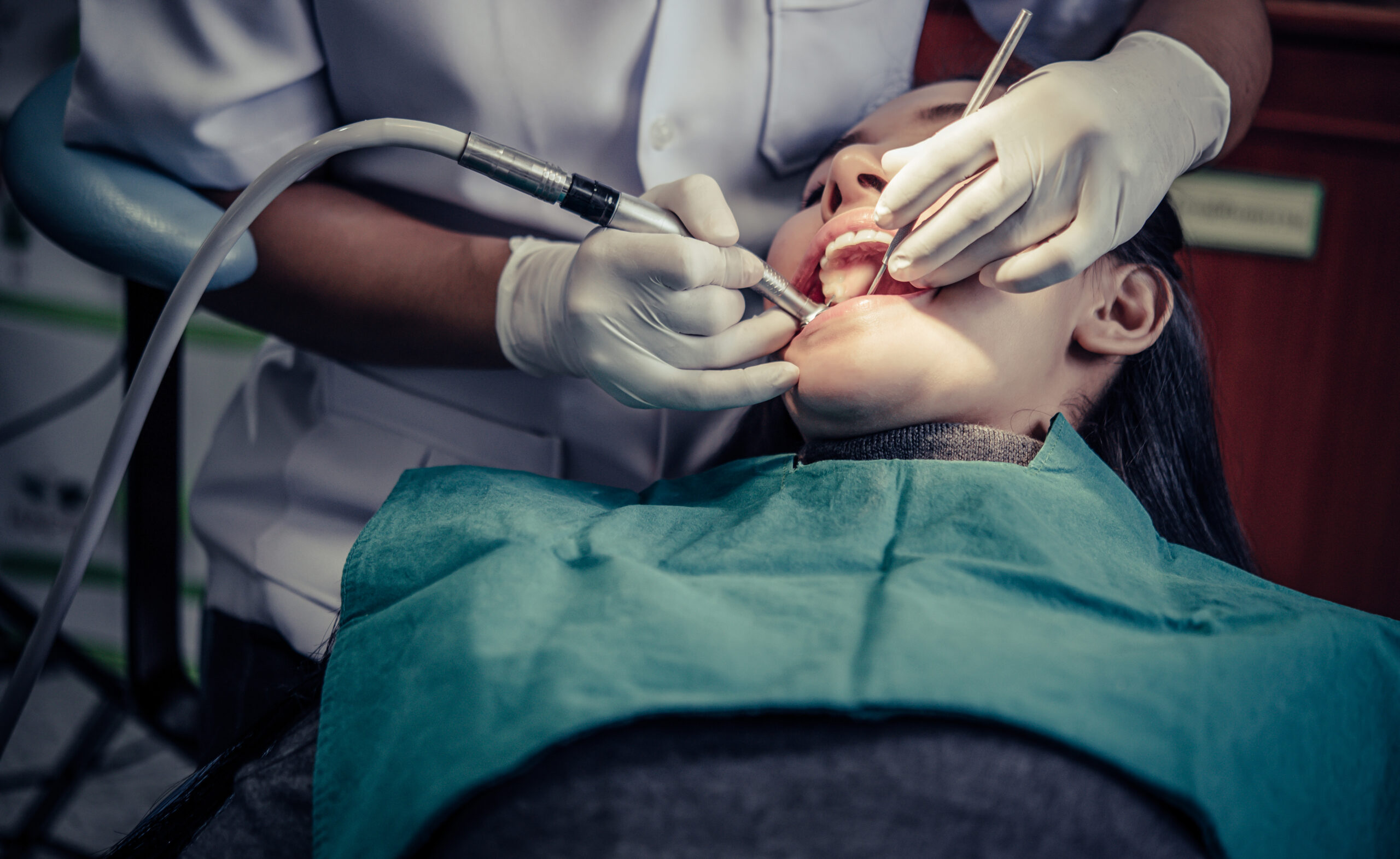 Tooth Extraction Melbourne – Painless Dental Care