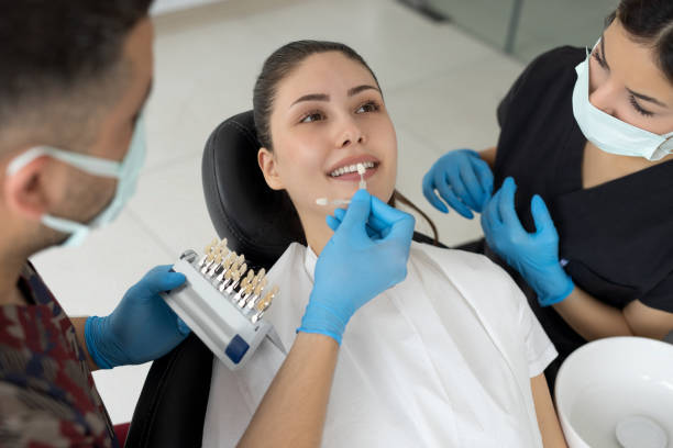 Veneers