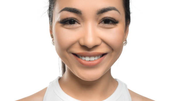 Snap-On Smile