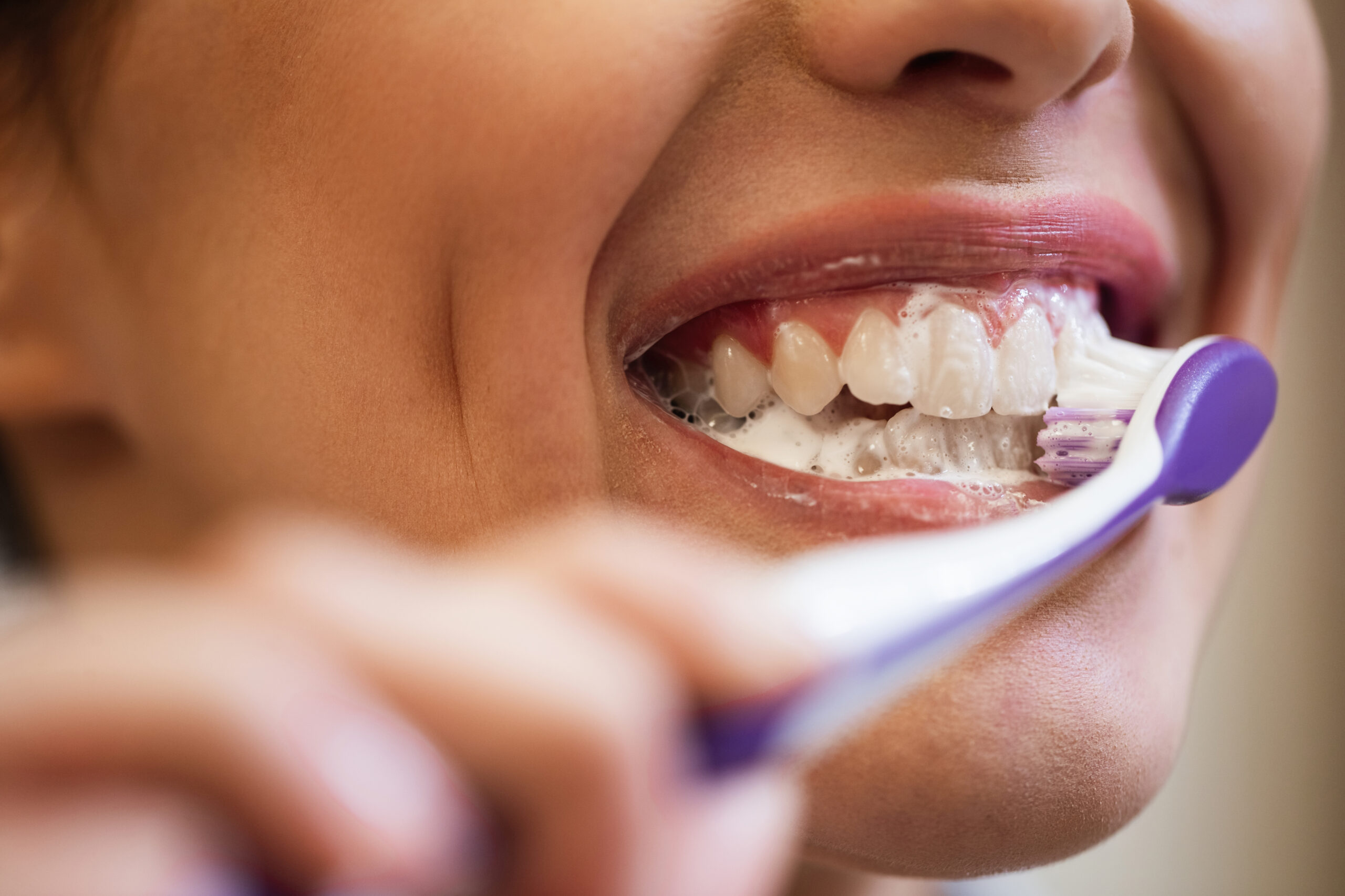 Teeth Cleaning