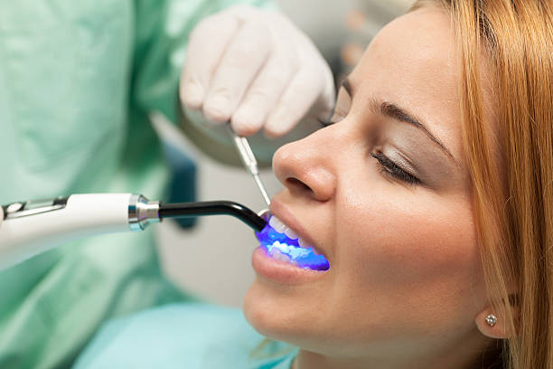 Tooth Fillings​