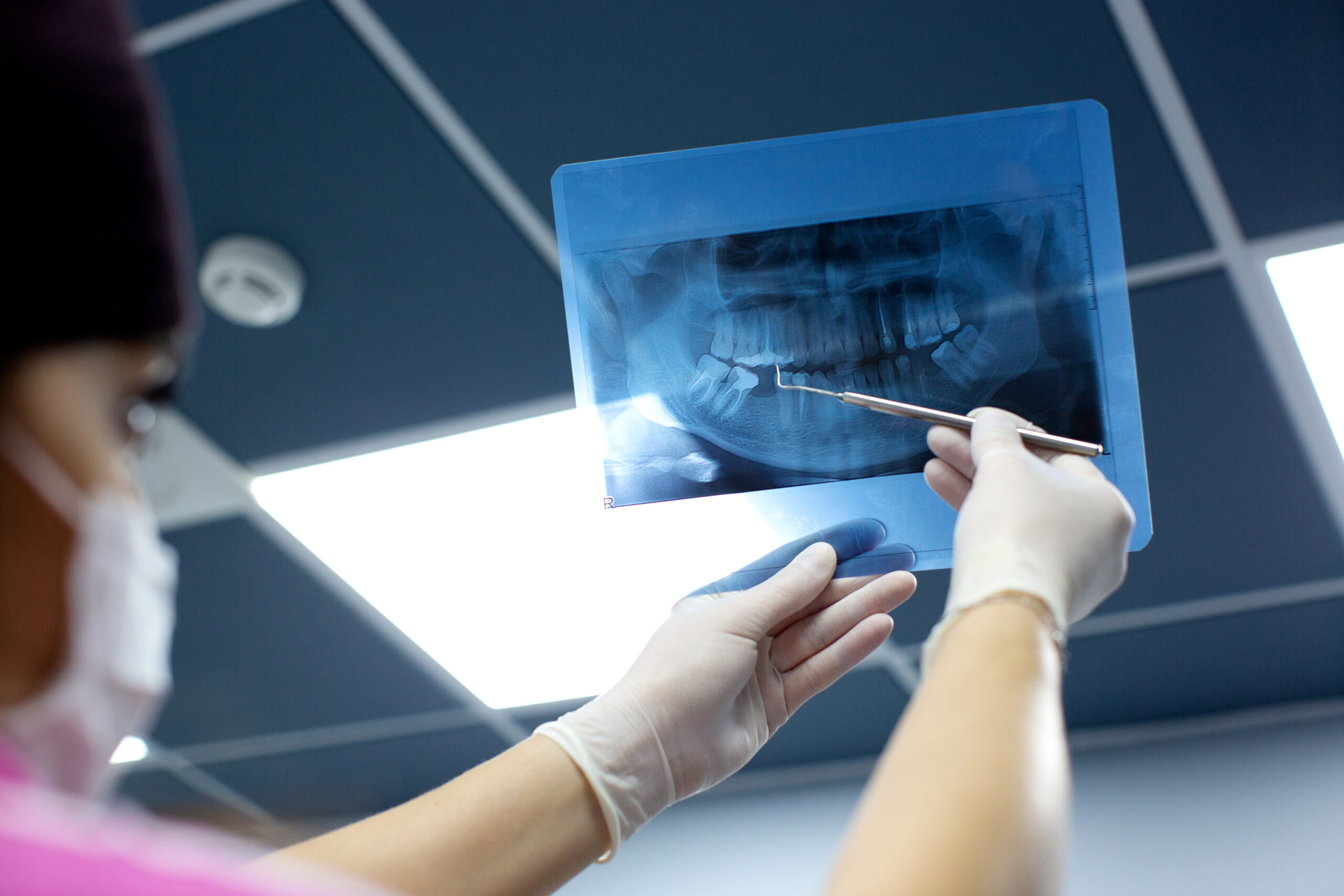 Digital Dental X-Rays